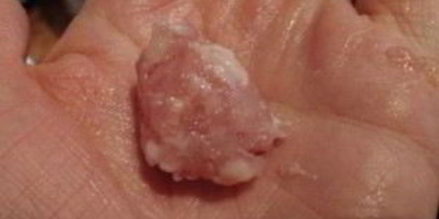 суп с куриными фрикадельками и овощами